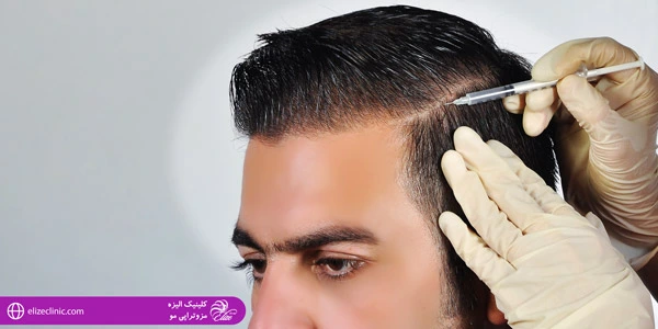 Hair-mesotherapy