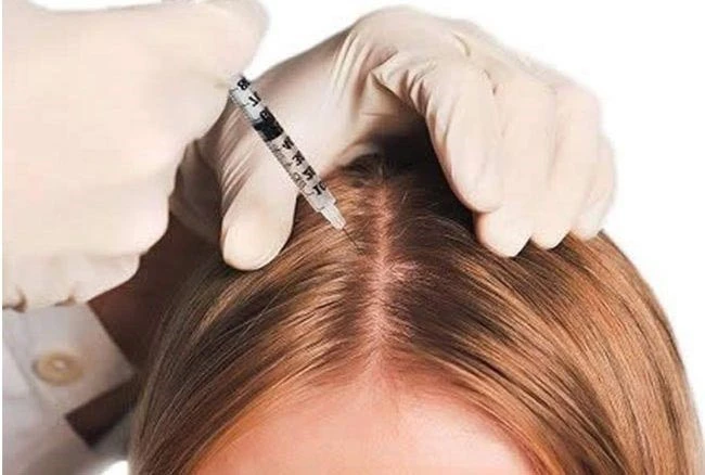 Best-doctor-hair-mesotherapy