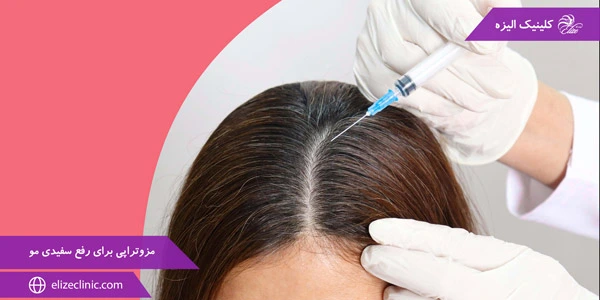 Mesotherapy-to-remove-white-hair