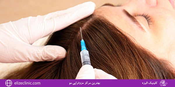 best-hair-mesotherapy-center