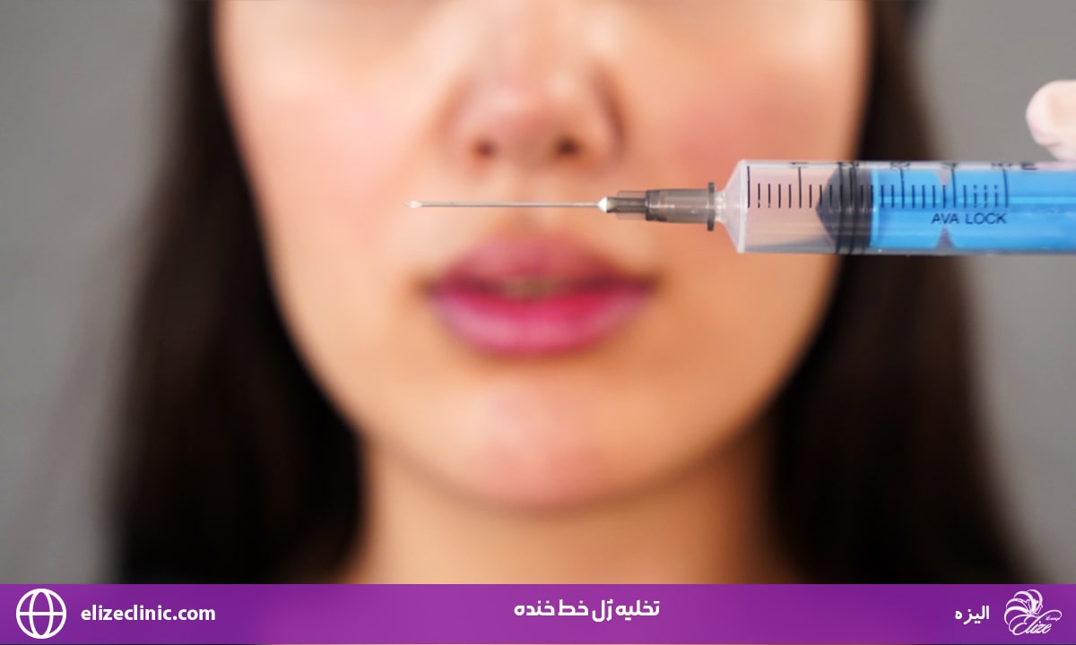 تخلیه ژل خط خنده